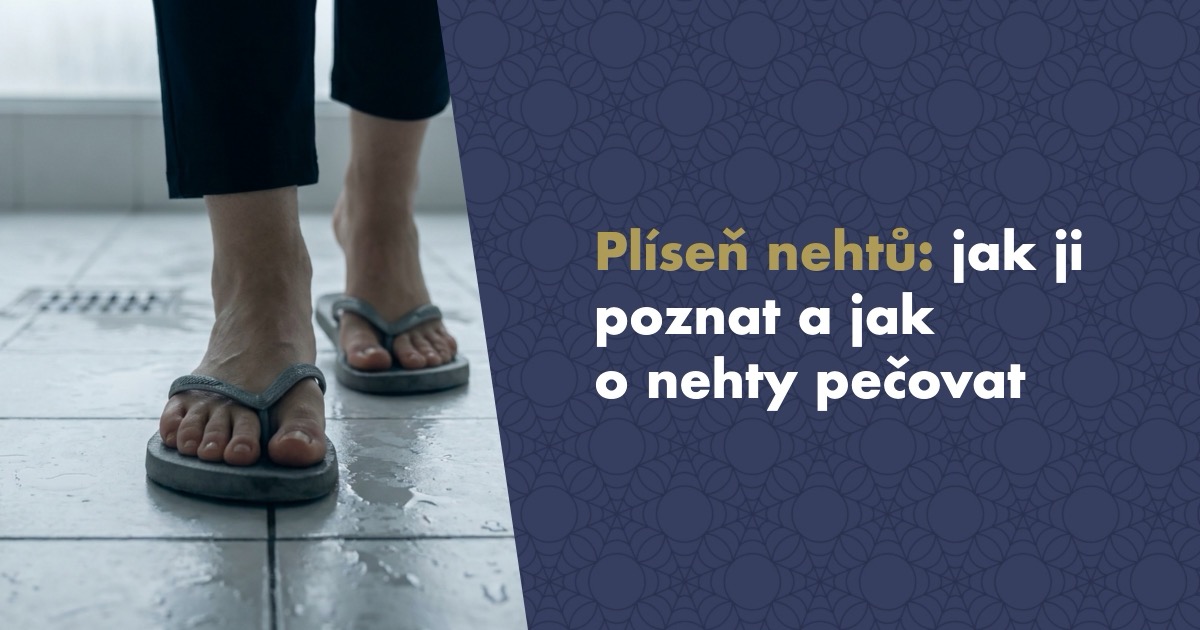 Plíseň nehtů (onychomykóza): jak ji poznat, léčit a pečovat o nehty
